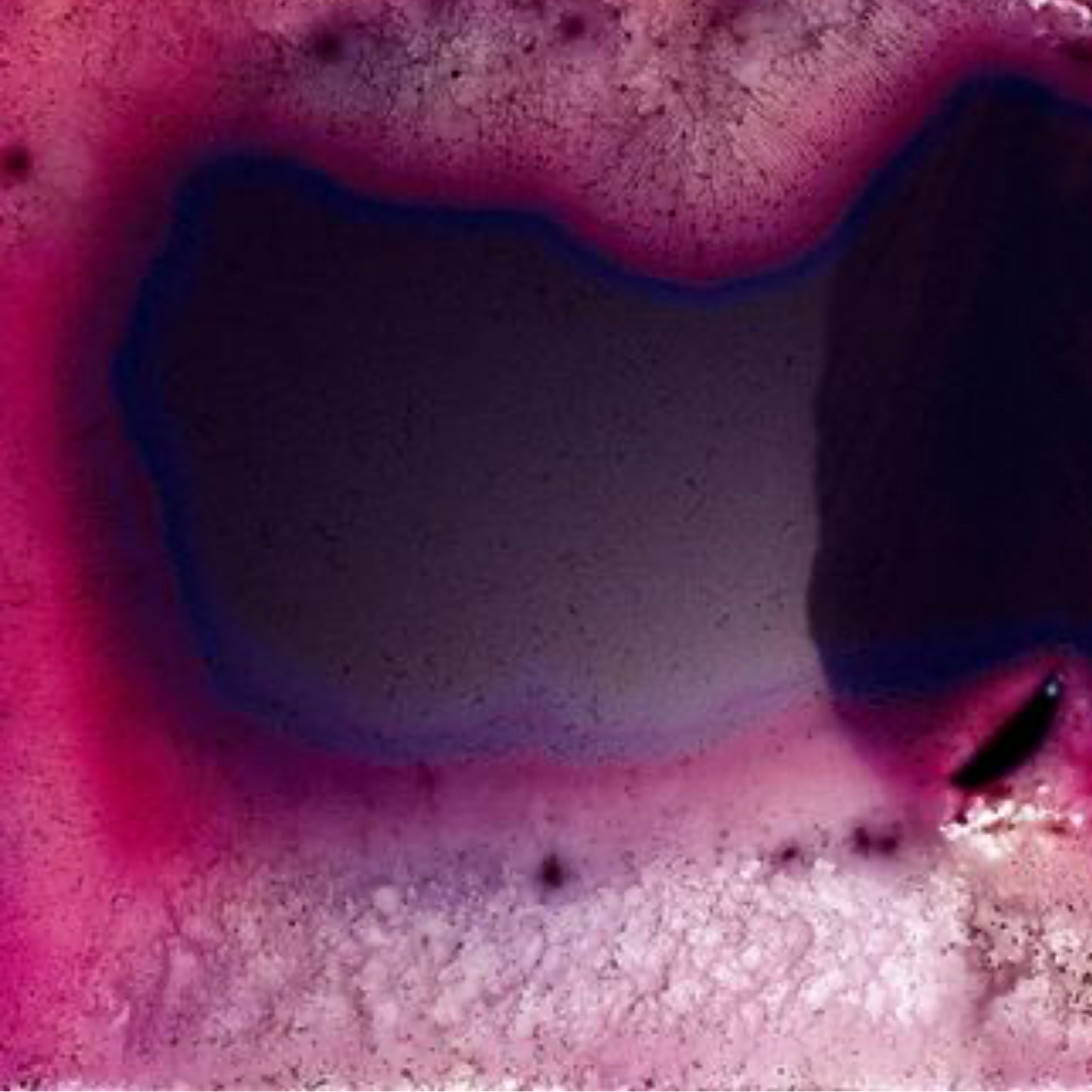 Deterioration Series 126, 1984 - 2013