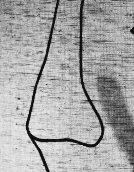 Untitled (Shadow and Face)